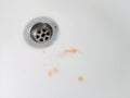 Bubble toothpaste and blood in the sink. scurvyÃ¢â¬â¹ gum health and teeth that should not be neglectedÃ¢â¬â¹.